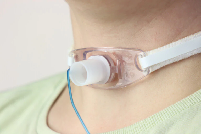 Tracheostomy Management